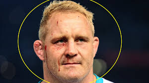 🚨There's an image floating around of Vincent Koch & it has everyone  scratching their heads .. 😬