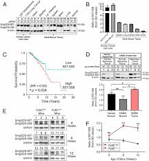 Enter english text or a web page to simplify: Splice Switching An Oncogenic Ratio Of Smggds Isoforms As A Strategy To Diminish Malignancy Pnas