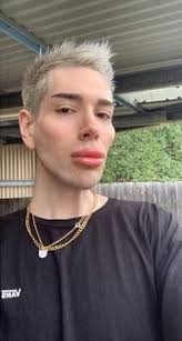 TÉMOIGNAGE J'ai dépensé une fortune en chirurgie esthétique pour ressembler  à la poupée Ken