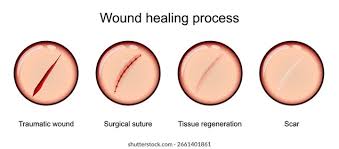 Image result for Wound Repair