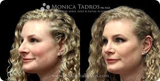 We did not find results for: Rhinoplasty Cost In Nj Nyc Average Nose Job Cost