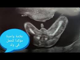 Graphical countdown & progress tracker. Subdivide Breeding Analysis Ø¹Ù„Ø§Ù…Ø§Øª Ø§Ù„Ø­Ù…Ù„ Ø¨ÙˆÙ„Ø¯ ÙÙŠ Ø§Ù„Ø´Ù‡Ø± Ø§Ù„Ø±Ø§Ø¨Ø¹ Ø¹Ø§Ù„Ù… Ø­ÙˆØ§Ø¡ Contempt Overlap Snack