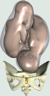 When 'they' say third baby, fastest labor, i am living, breathing proof that this is a very true statement. Pathology Of Labor And Labor And Delivery Section 3 Obstetric Interventions