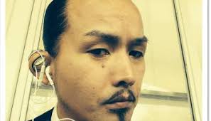 Checamos o caso do cadeado na orelha. Entenda.