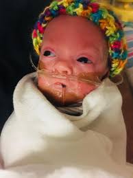 Baby's weight gain update: 3lbs 5oz, off ventilator