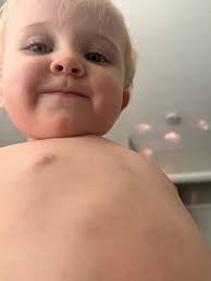 Big prayers today for both of my babies: Bennett: Bennett is back in  Eastern Kentucky with NeNe (my aunt) because he has his 18 month well child  visit today. He will be