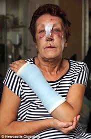 Great-grandmother, 64, dies of cancer after vicious handbag mugging