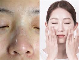 Kết quả hình ảnh cho HÌNH ẢNH TRỊ NÁM CON GÁI