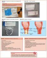 This is than sent for culture and sensitivity. Use Of A Vaginal Speculum And Taking A Vaginal Swab Nurse Key
