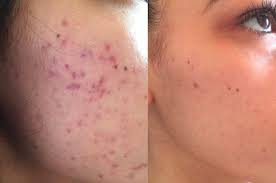 Pin On Beauty Skin