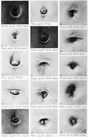 Image result for Umbilicus botryoides