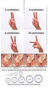See full list on wikihow.com Mdsmafe What Is Cervical Dilation Cervical Dilation Facebook
