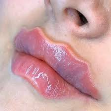 Gibt man bei instagram die hashtags „krakenlippen oder „octopuslips ein, findet man nicht etwa bilder von tintenfischen. Trend In Instagram Octopus Lippen Mode Person