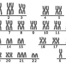 Nondisjunction In Meiosis I And Meiosis Ii Download Scientific Diagram