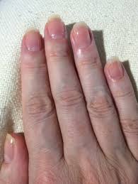 Now 27 years old, i've been picking and biting the skin on my fingers for as long as i can remember, leaving them scabbed and painful. After A Lifetime Of Biting My Fingernails Will They Ever Really Return To Normal Quora