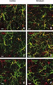 Maybe you would like to learn more about one of these? Increased Levels Of Proinflammatory Cytokines In The Aged Rat Brain Attenuate Injury Induced Cytokine Response After Excitotoxic Damage Campuzano 2009 Journal Of Neuroscience Research Wiley Online Library