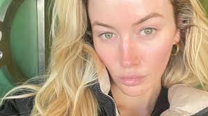 Skin needling: Samantha Appel opens fifth The Skin Bar clinic in Sydney