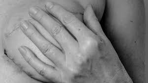 Seffrin earned total compensation of $856,442 as ceo of the american cancer society last year, in addition to $77,859 as president of the acs cancer action network, the nonprofit, nonpartisan advocacy affiliate. Breast Cancer Surgery Types Recovery Time Cost And More