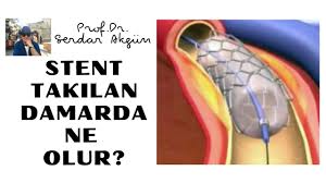 Prof Dr Serdar Akgun Panosundaki Pin