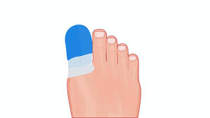 Image result for Toenail Removal