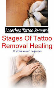 Pin On Tattoo Removal
