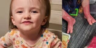 Mom seeking jail time for day care owner accused of burning child in  scalding hot water