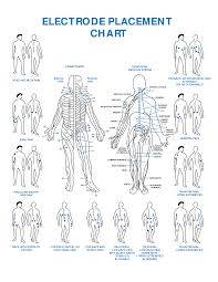 Tens Electrode Placement Chart Pdf Bedowntowndaytona Com