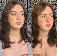 Curious if anyone knows of a pet groomer that can remove mats from cat fur? 