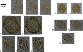 Image result for Dasylepis