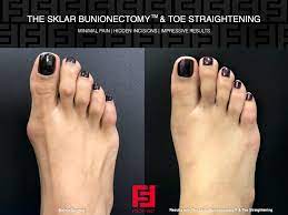 Cosmetic surgery can be performed on any part of the face and body. Cosmetic Foot First Podiatry Centers