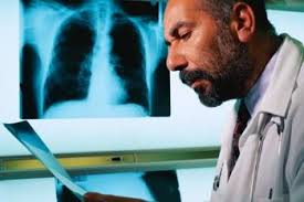 Copd is a term used for a group of obstructive lung diseases. Can Pneumonia Look Like Something Else On An X Ray