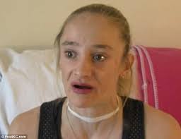 Anorexic woman who once weighed just 56LBS debuts healthier body two years 