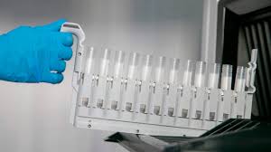 La gripe aviar y el ébola dejaron sufrimiento y víctimas, pero también aprendizaje que se ha aplicado en la crisis del coronavirus. Rusia Alerta Del Primer Caso De Gripe Aviar H5n8 Detectado En Humanos