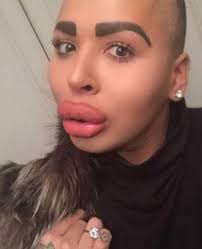 Soooooo.... Jordan Parkes dream has come true...... and now he can make  everybody look like this!!! 🤦🏼‍♀️ Can you believe that a reality  'celebrity' has been 'trained' to inject people's faces?? With