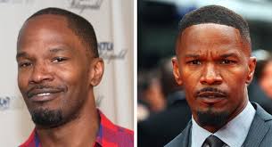 Atl scalp micro isn't your typical hair loss center. Celebrity Hair Transplant Top 11 Celebrities Surgery