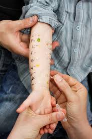 Image result for Allergy Screening