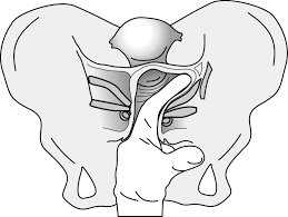 See more of mike thiele sports massage & soft tissue therapy on facebook. Prevalence Of Pelvic Floor Dysfunction In Patients With Interstitial Cystitis Urology