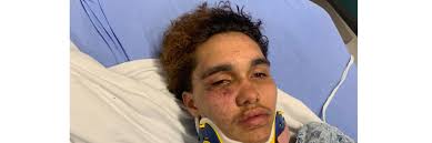 A transgender teen in Massachusetts says other high schoolers beat him at a  party