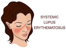 This is an effective ayurvedic remedy to get rid of black patches / melasma. Systemic Lupus Erythematosus Sle Ayurvedic Natural Treatment In South Australia Adelaide