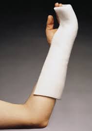 Image result for Radial Gutter Cast