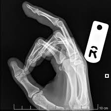 Pin On Chronicles Of A Med Nerd