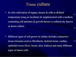 Animal cells can be cultured either us. Animal Tissue Culture