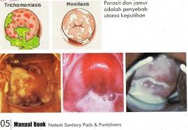 Maybe you would like to learn more about one of these? Serba Serbi Keputihan Pada Gold G Sea Cucumber Jelly Facebook