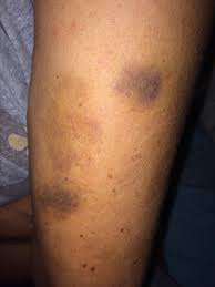 Shop the site, check the pattern notes, and follow us on social media. Rosa Villa Fala Sobre Violencia Domestica Estou Traumatizada Holofote