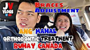PAANO MAG PAKABET NG DENTAL BRACES DITO SA CANADA| MAG KANO KAYA ANG GASTOS  |BUHAY CANADA|JV VLOGS