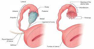 The occurrence of fallopian tube tumors that arise in the fimbriae has received scanty attention in the literature. Easy Notes On Uterine Tubes Fallopian Tubes Learn In Just 3 Mins Earth S Lab