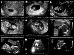 Wenn du schlank bist, kannst du nun evt. Entwicklung Von Embryo Fotus Wachstum Im Mutterleib 9monate De