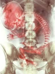 Science Photo Library X Ray Science Photos Medical
