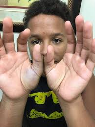 Darby Allin says he's officially been medically cleared to return at  tonight's Dynamite 250, and describes his crazy injuries: I broke my foot 2  months ago and then got hit by a