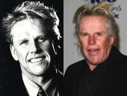 Plastic Surgery Just Say No Plastic Surgery Bad Plastic Surgeries Plastic Surgery Gone Wrong